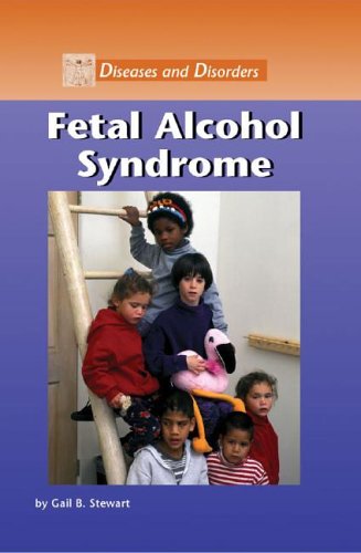 Fetal alcohol syndrome