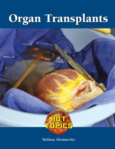 Organ transplants