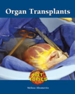 Organ transplants