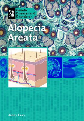 Alopecia areata