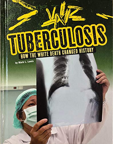 Tuberculosis : how the white death changed history