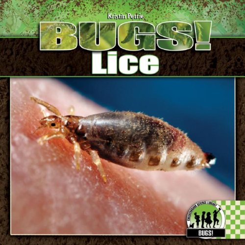 Lice