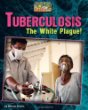 Tuberculosis : the white plague!