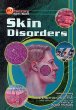 Skin disorders