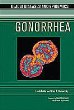 Gonorrhea