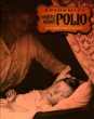 The battle against polio