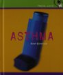 Asthma