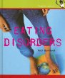 Eating disorders