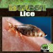 Lice