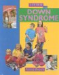 Living with Down syndrome /.