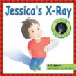 Jessica's x-ray