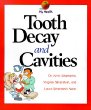 Tooth decay and cavities