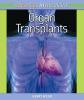 Organ transplants