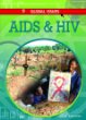 AIDS and HIV