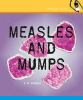 Measles and mumps