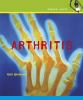 Arthritis