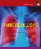 Tuberculosis