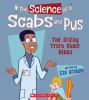 The science of scabs and pus : the sticky truth about blood