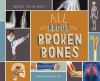 All about broken bones