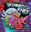 Your body battles a skinned knee
