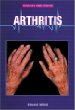 Arthritis